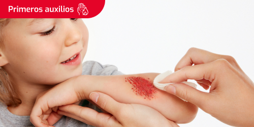 Persona limpieando un raspón a una niña Persona limpieando un raspón a una niña